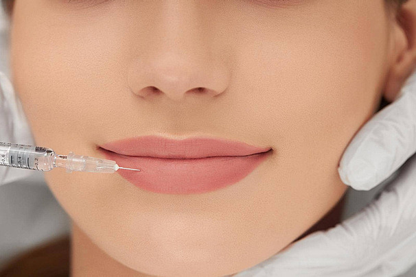 Lip Fillers Image